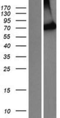 Western Blot: PIB5PA Overexpression Lysate (Adult Normal) [NBP2-10735] Left-Empty vector transfected control cell lysate (HEK293 cell lysate); Right -Over-expression Lysate for PIB5PA.