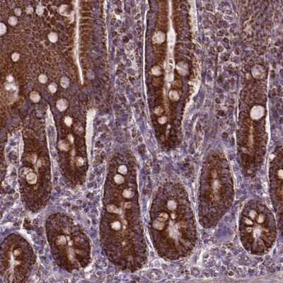 Immunohistochemistry: PIBF1 Antibody [NBP2-49474] - Staining of human duodenum shows cytoplasmic positivity in glandular cells.