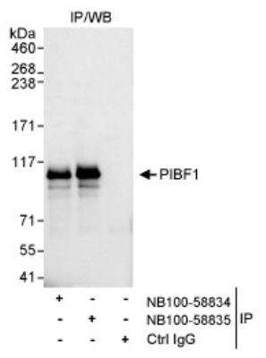 Western Blot: PIBF1 Antibody [NB100-58834] - Detection of Human PIBF1 by Western Blot of Immunoprecipitates. Samples:  Whole cell lysate (1 mg for IP, 20% of IP loaded) from HeLa cells.  Antibodies:  Affinity purified rabbit anti-PIBF1 antibody NB100-58834 used for IP at 3 mcg/mg lysate. PIBF1 was also immunoprecipitated by rabbit anti-PIBF1 antibody NB100-58835, which recognizes a downstream epitope.  Detection:  Chemiluminescence with an exposure time of 10 seconds.