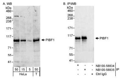 Western Blot: PIBF1 Antibody [NB100-58835] - Detection of Human PIBF1 on HeLa whole cell lysate using NB100-58835. PIBF1 was also immunoprecipitated by rabbit anti-PIBF1 antibody NB100-58834.