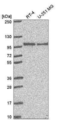 Western Blot: PIBF1 Antibody [NBP2-56805] - Analysis in human cell line RT-4 and human cell line U-251 MG.