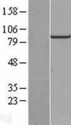Western Blot: PIBF1 Overexpression Lysate (Adult Normal) [NBL1-14389] Left-Empty vector transfected control cell lysate (HEK293 cell lysate); Right -Over-expression Lysate for PIBF1.