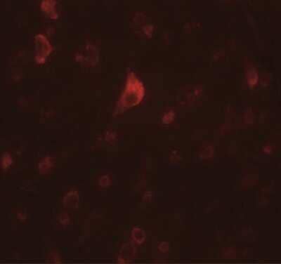 Immunocytochemistry/Immunofluorescence: PICALM Antibody [NBP1-76254] - Immunofluorescence of PICALM in human brain tissue with PICALM antibody at 20 ug/mL.