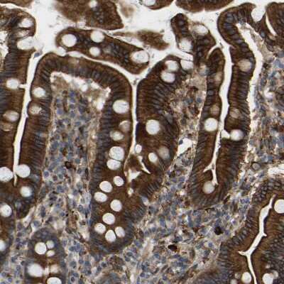 Immunohistochemistry-Paraffin: PICALM Antibody [NBP1-86658] - Staining of human duodenum shows strong membranous and cytoplasmic positivity in glandular cells.