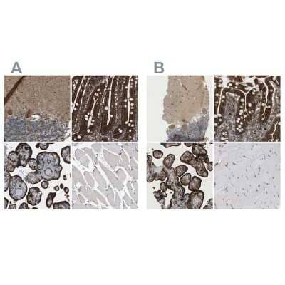 <b>Independent Antibodies Validation. </b>Immunohistochemistry-Paraffin: PICALM Antibody [NBP1-86659] - Staining of human cerebellum, duodenum, placenta and skeletal muscle using Anti-PICALM antibody NBP1-86659 (A) shows similar protein distribution across tissues to independent antibody NBP1-86658 (B).