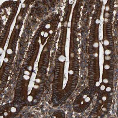 Immunohistochemistry-Paraffin: PICALM Antibody [NBP1-86659] - Staining of human duodenum shows strong membranous and cytoplasmic positivity in glandular cells.