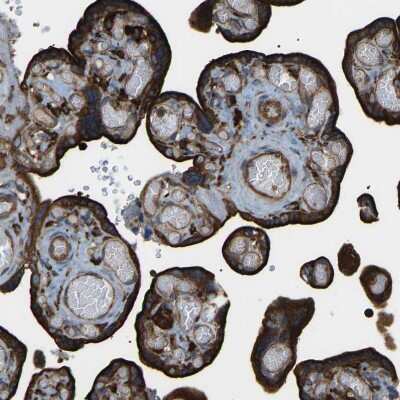 Immunohistochemistry-Paraffin: PICALM Antibody [NBP1-86659] - Staining of human placenta shows strong membranous and cytoplasmic positivity in trophoblastic cells.