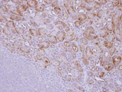 Immunohistochemistry-Paraffin: PICALM Antibody [NBP2-19825] - Immunohistochemical analysis of paraffin-embedded Renal Tubule, using antibody at 1:250 dilution.