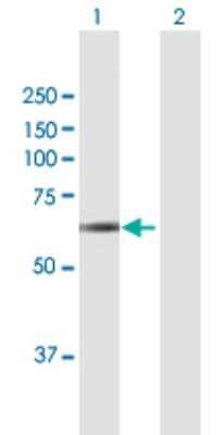 Western Blot: PICALM Antibody [H00008301-B01P] - Analysis of PICALM expression in transfected 293T cell line by PICALM polyclonal antibody.  Lane 1: PICALM transfected lysate(67.1 KDa). Lane 2: Non-transfected lysate.