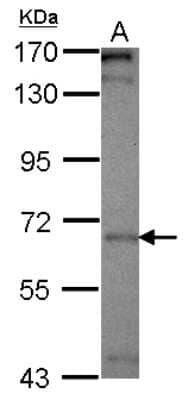 Western Blot: PICALM Antibody [NBP2-19824] - Sample (30 ug of whole cell lysate) A: HepG2 7. 5% SDS PAGE gel, diluted at 1:500.