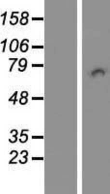 Western Blot: PICALM Overexpression Lysate (Adult Normal) [NBL1-14390] Left-Empty vector transfected control cell lysate (HEK293 cell lysate); Right -Over-expression Lysate for PICALM.