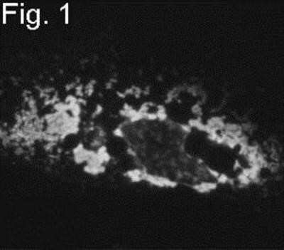 Immunocytochemistry/Immunofluorescence: PICK1 Antibody [NB120-3420] - Immunolocalization of PICK1 in CV1 cells transfected with both PICK1 and mGluR7a.
