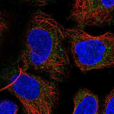 Immunocytochemistry/Immunofluorescence: PICK1 Antibody [NBP2-57239] - Staining of human cell line HEK 293 shows localization to mitochondria. Antibody staining is shown in green.