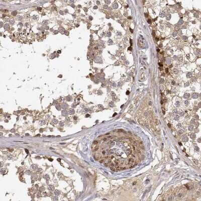 Immunohistochemistry-Paraffin: PICK1 Antibody [NBP2-57605] - Immunohistochemical staining of human testis shows strong cytoplsamic positivity in a subset of cells in seminiferous ducts.