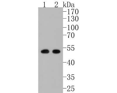Western Blot: PICK1 Antibody (JG30-80) [NBP2-76863] - Western blot analysis of PICK1 on different lysates. Proteins were transferred to a PVDF membrane and blocked with 5% BSA in PBS for 1 hour at room temperature. The primary antibody (1/500) was used in 5% BSA at room temperature for 2 hours. Goat Anti-Rabbit IgG - HRP Secondary Antibody (HA1001) at 1:5,000 dilution was used for 1 hour at room temperature. Positive control: Lane 1: SK-Br-3 cell lysate Lane 2: 293 cell lysate