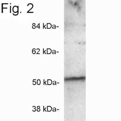 Western Blot PICK1 Antibody