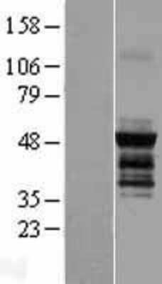 Western Blot: PICK1 Overexpression Lysate (Adult Normal) [NBP2-07450] Left-Empty vector transfected control cell lysate (HEK293 cell lysate); Right -Over-expression Lysate for PICK1.