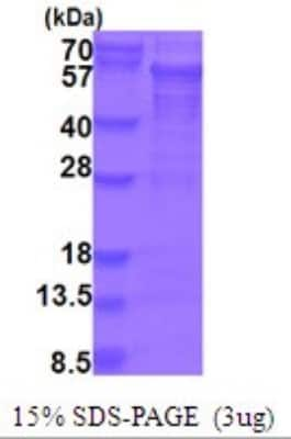 SDS-PAGE Recombinant Human PICK1 His Protein