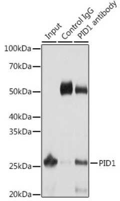Immunoprecipitation: PID1 Antibody [NBP2-93820] - Immunoprecipitation analysis of 25ug extracts of Mouse liver cells using 3ug PID1 antibody (NBP2-93820). Western blot was performed from the immunoprecipitate using PID1 antibody (NBP2-93820) at a dilution of 1:1000.