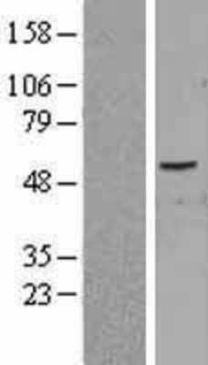 Western Blot: PID1 Overexpression Lysate (Adult Normal) [NBP2-04366] Left-Empty vector transfected control cell lysate (HEK293 cell lysate); Right -Over-expression Lysate for PID1.
