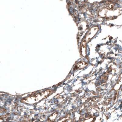 Immunohistochemistry-Paraffin: PIEZO1 Antibody [NBP2-13758] - Staining of human lung shows positivity in erythrocytes.