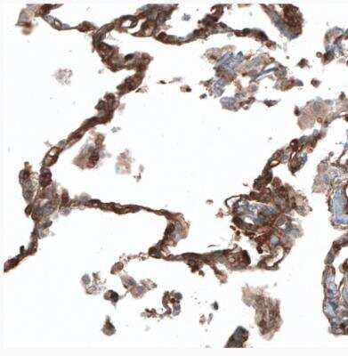 Immunohistochemistry-Paraffin: PIEZO1 Antibody [NBP2-13758] - Staining of human lung shows moderate positivity in pneumocytes.