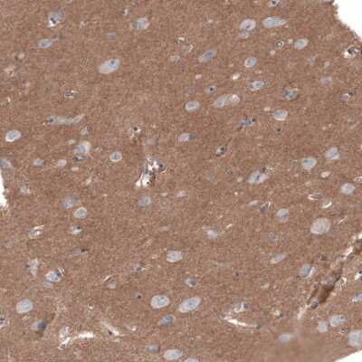 Immunohistochemistry-Paraffin: PIEZO1 Antibody [NBP2-13758] - Staining of human cerebral cortex shows moderate cytoplasmic positivity in neuropil.