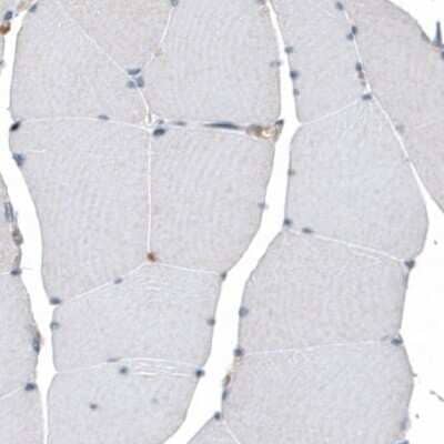 Immunohistochemistry-Paraffin: PIEZO1 Antibody [NBP2-13758] - Staining of human skeletal muscle shows no cytoplasmic positivity in myocytes as expected.