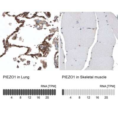 Immunohistochemistry-Paraffin: PIEZO1 Antibody [NBP2-13758] - Staining in human lung and skeletal muscle tissues . Corresponding PIEZO1 RNA-seq data are presented for the same tissues.