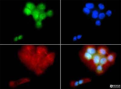 Immunocytochemistry/Immunofluorescence: PIEZO2 Antibody [NBP1-78624] - PIEZO2 antibody was tested at 1:50 in A431 cells with FITC (green) .Nuclei and alpha-tubulin were counterstained with DAPI (blue) and DyLight 550 (red).