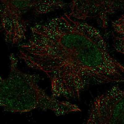 Immunocytochemistry/Immunofluorescence: PIEZO2 Antibody [NBP2-58161] - Staining of human cell line HeLa shows localization to nucleoplasm & vesicles. Antibody staining is shown in green.