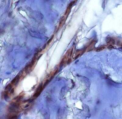 Analysis of PIEZ02 in mouse epidermis using DAB with hematoxylin counterstain.