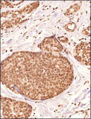 Analysis of a FFPE tissue section of human breast using 1:200 dilution of PIEZO2 antibody. The staining was developed using HRP labeled anti-rabbit secondary antibody and DAB reagent, and nuclei of cells were counter-stained with hematoxylin.