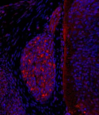 Analysis of PIEZO2 in dorsal root ganglion of embryonic day (E) 13.5 mouse. PIEZO2 in red, DAPI in blue. Antigen retrieval with 1x DAKO antigen retrieval solution, by heating in a microwave oven, for total time of 6 minutes 10 seconds. Washing buffer 1 x PBS with 0.1% Triton X-100. Blocking in 5% donkey serum (Jackson lab) in washing buffer. Primary antibody diluted 1:1000, incubation 18 hours in room temperature. Secondary antibody donkey anti-rabbit Cy3, 1:400, 3 hours in room temperature. Image from verified customer review.