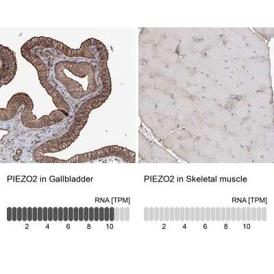 Immunohistochemistry-Paraffin: PIEZO2 Antibody [NBP1-89892] - Analysis in human gallbladder and skeletal muscle tissues. Corresponding PIEZO2 RNA-seq data are presented for the same tissues.
