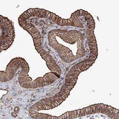 Immunohistochemistry-Paraffin: PIEZO2 Antibody [NBP1-89892] - Staining of human gallbladder shows strong membranous positivity in glandular cells.