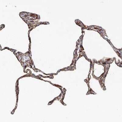 Immunohistochemistry-Paraffin: PIEZO2 Antibody [NBP1-89892] - Staining of human lung shows strong membranous positivity in pneumocytes.