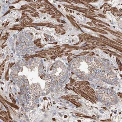 Immunohistochemistry-Paraffin: PIEZO2 Antibody [NBP1-89892] - Staining of human prostate shows strong membranous positivity in smooth muscle cells and weak in glandular cells..