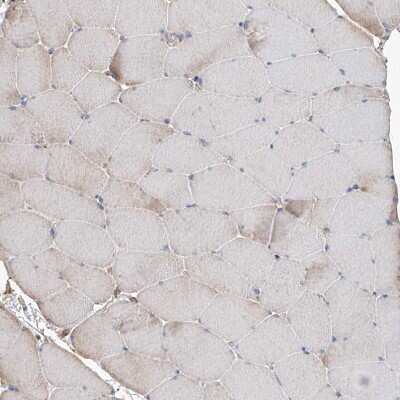 Immunohistochemistry-Paraffin: PIEZO2 Antibody [NBP1-89892] - Staining of human skeletal muscle shows low positivity in myocytes as expected.