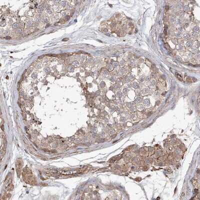 Immunohistochemistry-Paraffin: PIEZO2 Antibody [NBP1-89892] - Staining of human testis shows weak to moderate membranous positivity in Leydig cells and cells in seminiferous ducts.
