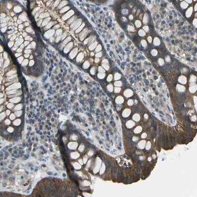 Immunohistochemistry-Paraffin: PIEZO2 Antibody [NBP1-89893] - Staining of human colon shows moderate cytoplasmic positivity in glandular cells.