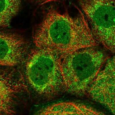 Immunocytochemistry/Immunofluorescence: PIG13 Antibody [NBP1-80904] - Immunofluorescent staining of human cell line A-431 shows localization to nucleoplasm & cytosol.