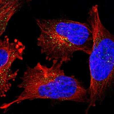 <b>Independent Antibodies Validation. </b>Immunocytochemistry/Immunofluorescence: PIG3 Antibody [NBP1-87275] - Staining of human cell line U-251 MG shows localization to vesicles. Antibody staining is shown in green. 