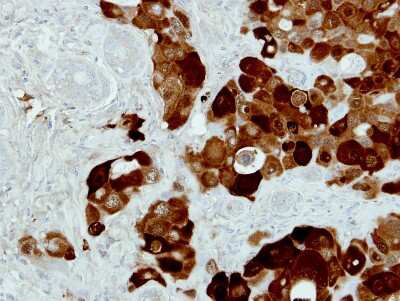 Immunohistochemistry-Paraffin: PIG3 Antibody [NBP1-33237] - Paraffin-embedded H441 xenograft, using antibody at 1:500 dilution.