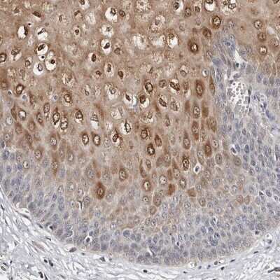 Immunohistochemistry-Paraffin: PIG3 Antibody [NBP1-87274] - Staining of human esophagus shows high expression.