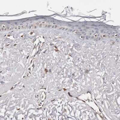 Immunohistochemistry-Paraffin: PIG3 Antibody [NBP1-87274] - Staining of human skin shows low expression as expected.