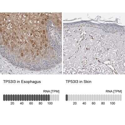 <b>Independent Antibodies Validation and Orthogonal Strategies Validation.</b>Immunohistochemistry-Paraffin: PIG3 Antibody [NBP1-87274] - Staining in human esophagus and skin tissues using anti-TP53I3 antibody. Corresponding TP53I3 RNA-seq data are presented for the same tissues.