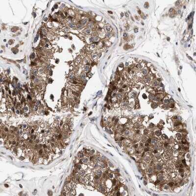 Immunohistochemistry-Paraffin: PIG3 Antibody [NBP1-87275] - Staining of human testis shows strong cytoplasmic positivity in cells in seminiferous ducts.