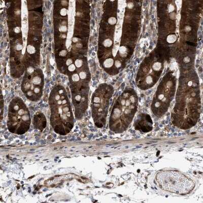 Immunohistochemistry-Paraffin: PIG3 Antibody [NBP1-87275] - Staining of human duodenum shows strong cytoplasmic positivity in glandular cells.