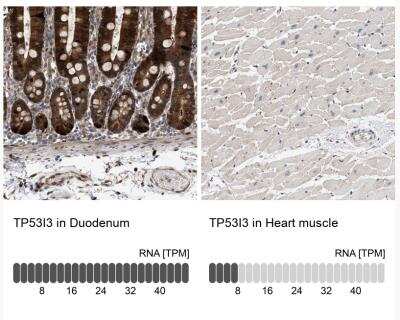 <b>Orthogonal Strategies Validation. </b>Immunohistochemistry-Paraffin: PIG3 Antibody [NBP1-87275] - Analysis in human duodenum and heart muscle tissues. Corresponding TP53I3 RNA-seq data are presented for the same tissues.